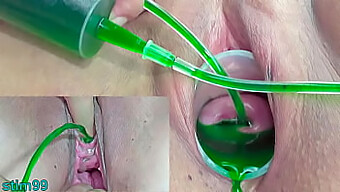 Japanese Lesbians Experiment With Cervix And Urethral Inflation Using Injections